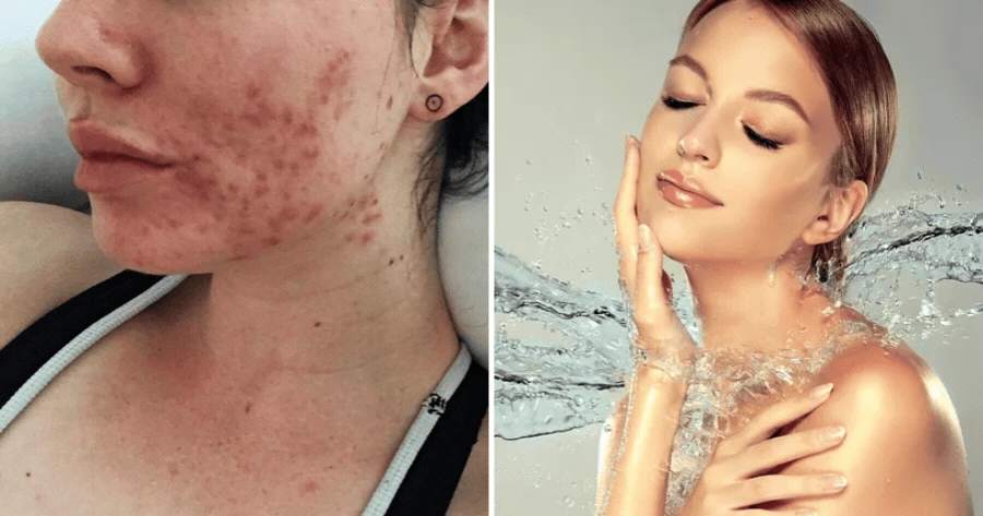 How Healthy Is Your Skin? Find Out Now!